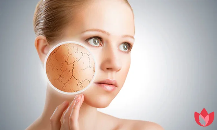 کرم آبرسان چیست و چرا استفاده از آن ضروری است؟